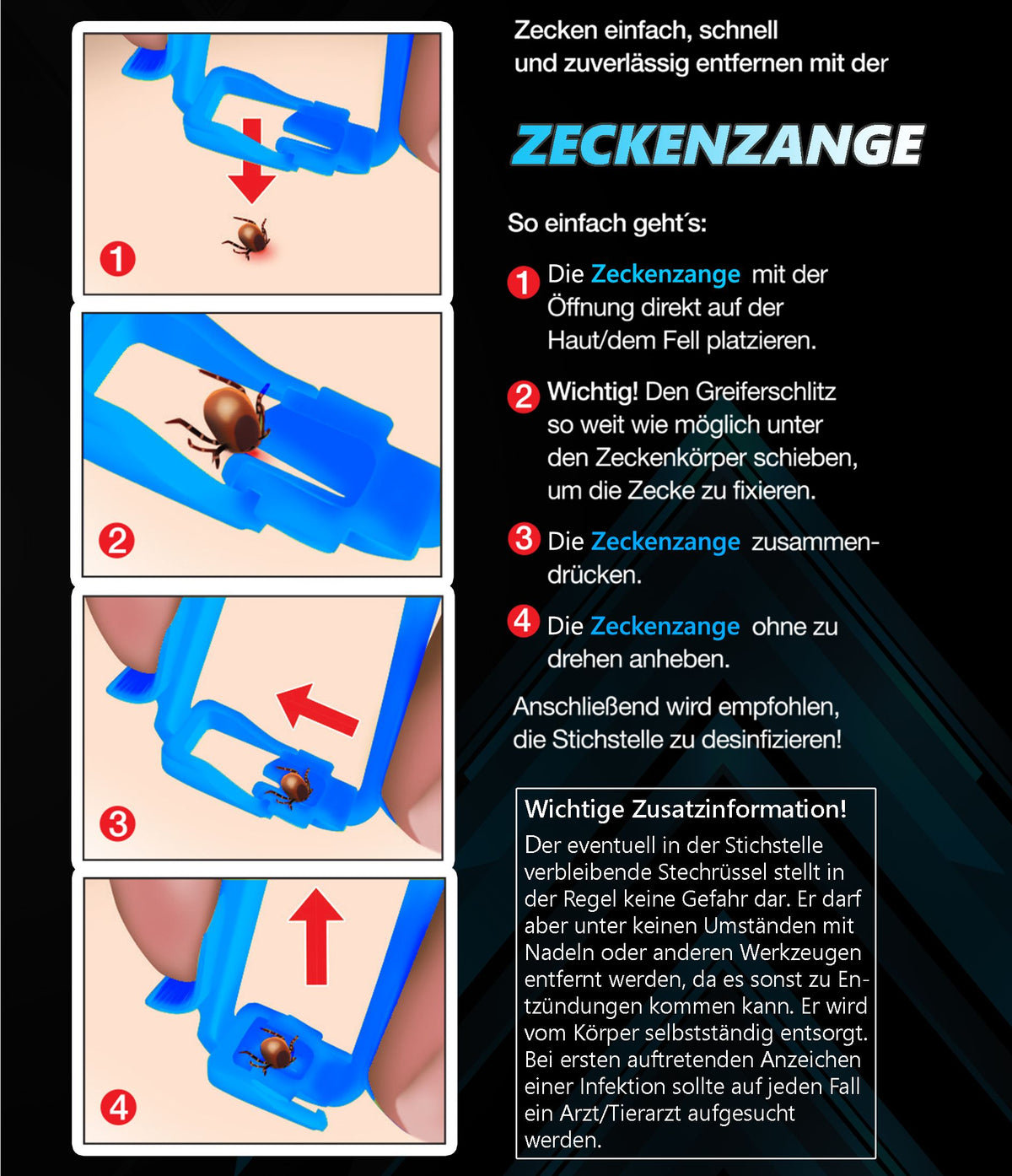 Zeckenzange mit Anhebefunktion – Ansicht 5